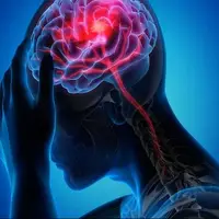 مراجعه سریع به بیمارستان کلید درمان مؤثر سکته مغزی است