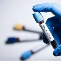 سازمان جهانی بهداشت: «ام پاکس» در کشورهای بیشتری شناسایی شده است