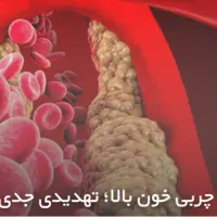 چربی خون بالا؛ تهدیدی جدی برای سلامت جامعه