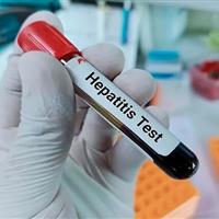 هشدار شیوع بالای هپاتیت A در کودکان و نوجوانان ایرانی