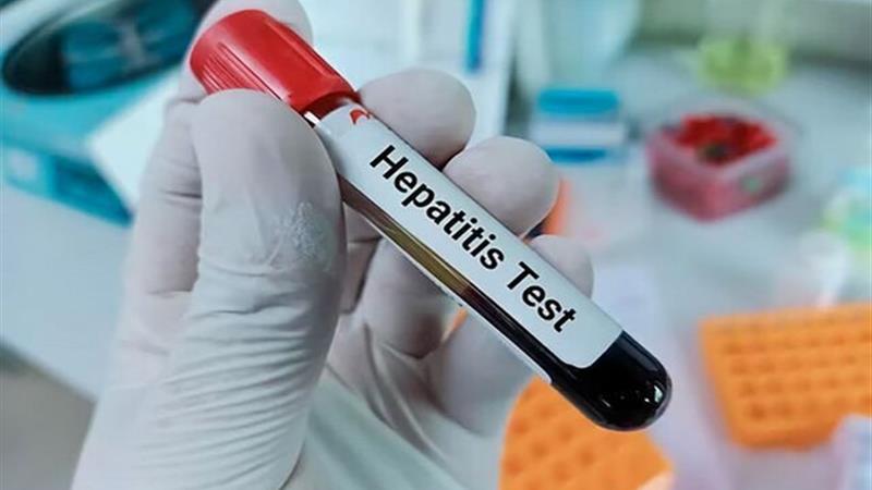 هشدار شیوع بالای هپاتیت A در کودکان و نوجوانان ایرانی