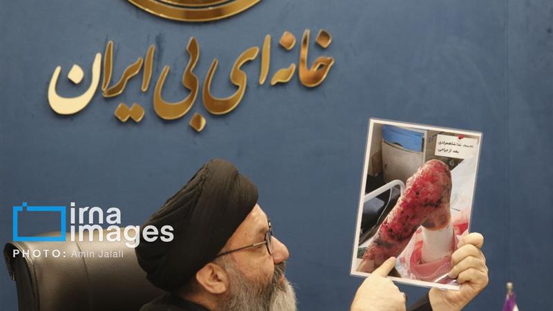 شناسایی ۱۲۵۰ بیمار پروانهای در کشور