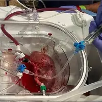 پیوند اولین کلیه هیبریدی انسان-خوک در اسپانیا