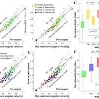 راهکاری نوین برای تشخیص و درمان آرتروز لگن در دانشگاه تهران