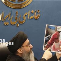 شناسایی ۱۲۵۰ بیمار پروانهای در کشور