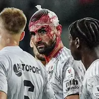 شکستگی سر وحشتناک سردار در دیدار باشاکشهیر