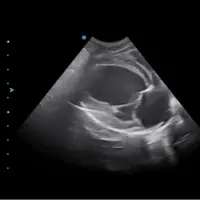 با مزه ترین سونوگرافی تاریخ