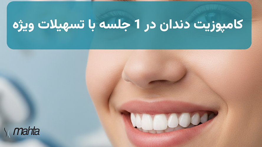 کامپوزیت دندان در 1 جلسه + وام ۳۰۰ میلیونی (خبر خوب برای تهرانیها)