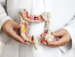 درمان کرم روده