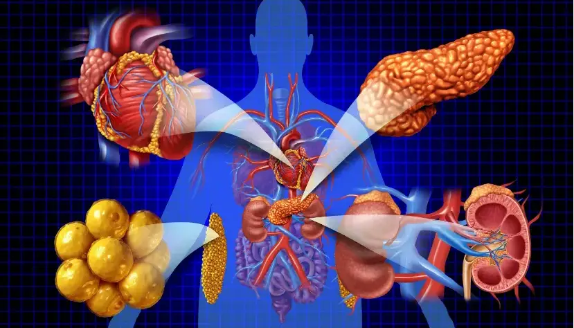 بیشتر مردم درمعرض ابتلا به یک بیماری مهم هستند؛ اما حتی نامش را هم نشنیده‌اند