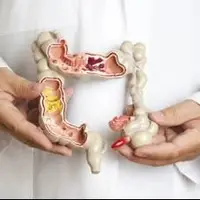 درمان کرم روده