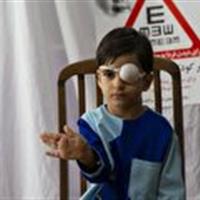 غربالگری بینایی و شنوایی بیش از ۱۷ هزار و ۵۰۰ کودک در خراسان جنوبی