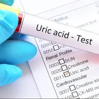 کاهش فوری اسیداوریک