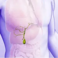  نوع نژاد در مبتلا شدن به کیسه صفرا نقش دارد!