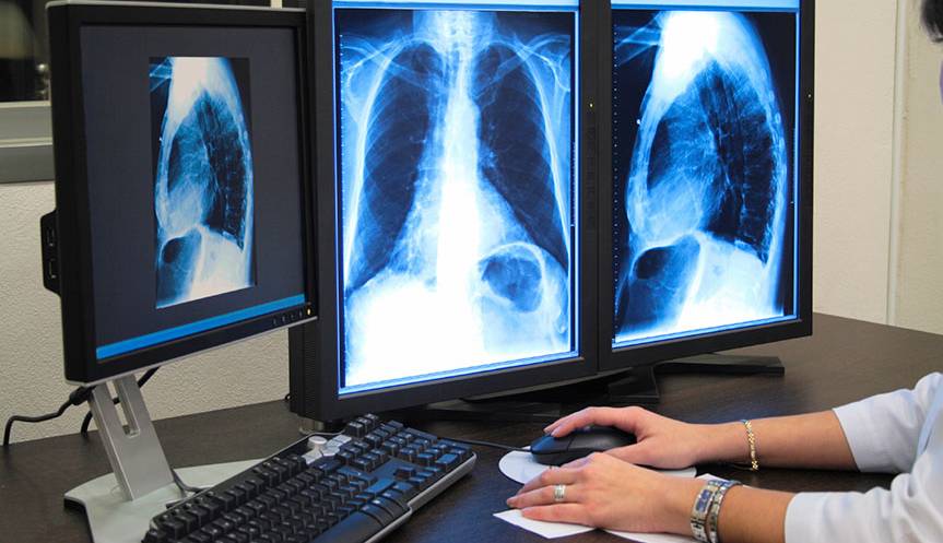 کمبود رادیولوژیست در کهگیلویه و بویراحمد