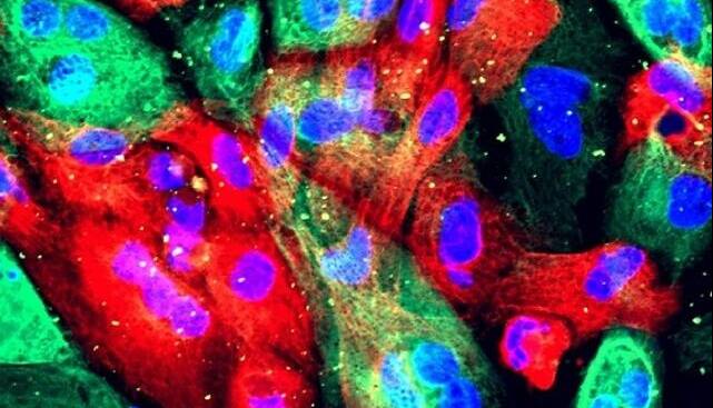 پژوهشی درباره رشد طبیعی یک آنزیم تا شکلگیری تومور از آن/ «کینازها» شمشیر دولبه در بدن انسان