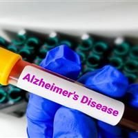 تاثیر پیادهروی روزانه بر مهار آلزایمر