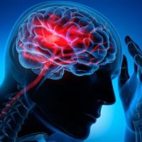 سکته مغزی دومین علت مرگ و میر در ایران است/ نرخ بروز در کشور ۱.۵ برابر نرم جهانی