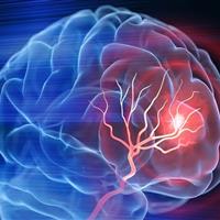 آلزایمر همیشه ارثی نیست؛ مراقبت‌های روزمره نقش کلیدی دارند