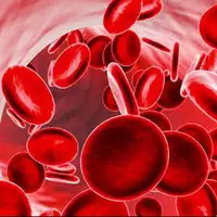 علائمی که ممکن است با کم خونی اشتباه گرفته میشود