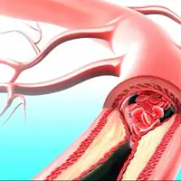 دارویی که همزمان با بیماری قلبی و دیابت مقابله میکند