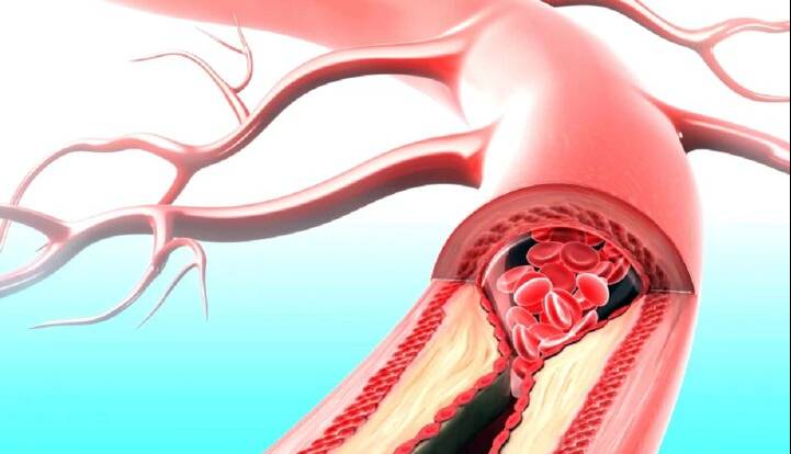 دارویی که همزمان با بیماری قلبی و دیابت مقابله میکند
