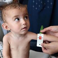 کاهش لاغری و کوتاهی قد؛ اثرات طرح حمایت تغذیهای در اسفراین