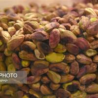 تأثیر مصرف پسته در شب بر میکروبیوم روده در مبتلایان پیش‌دیابت