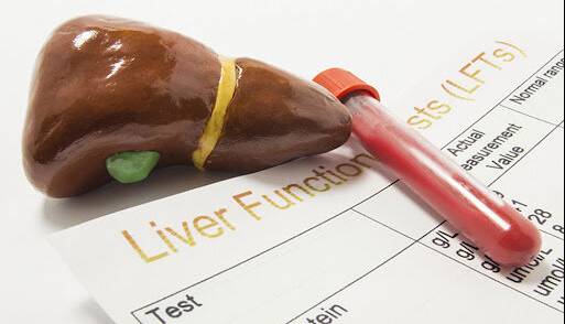 علت بالا رفتن آنزیمهای کبدی چیست؟
