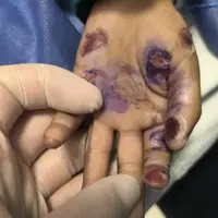 بچه ۴ ساله هرمزگانی قربانی کودکآزاری شد