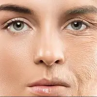 تاثیر استفاده از ضد آفتاب مناسب در کاهش پیری پوست