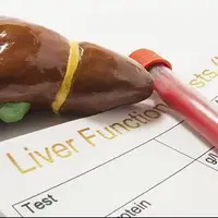 علت بالا رفتن آنزیمهای کبدی چیست؟