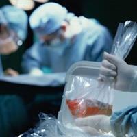 چالش اهدای عضو با مرگ صابر کاظمی