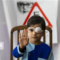 درمان بیش از ۱۳ هزار مورد تنبلی چشم در کودکان