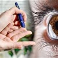 از هر پنج بیمار دیابتی، یک نفر دچار عوارض چشمی میشود