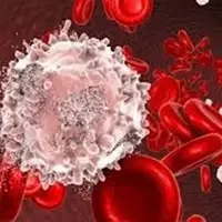 تولید یکی از پیچیدهترین داروهای سرطان خون در ایران