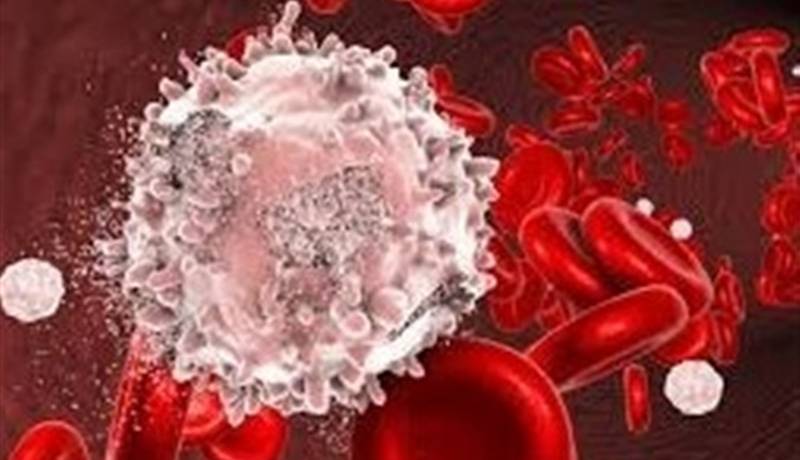 تولید یکی از پیچیدهترین داروهای سرطان خون در ایران