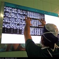 بیش از ۸۰ درصد بیماریهای ستون فقرات نیاز به عمل جراحی ندارد