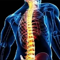 افزایش درد و مشکلات ستون فقرات در نسل جوان