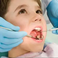 آیا کیفیت زندگی والدین بر پوسیدگی دندان کودکان اثر دارد؟