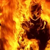 وضعیت وخیم احمد؛ جوان 20 سالهای که خودسوزی کرد در ICU بیمارستان اهواز