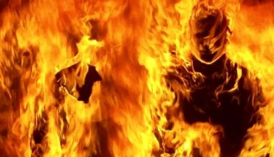 وضعیت وخیم احمد؛ جوان 20 سالهای که خودسوزی کرد در ICU بیمارستان اهواز