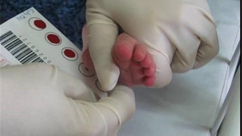 تداوم موفقیت برنامه ملی غربالگری تیروئید نوزادان با پوشش بیش از ۹۹ درصد