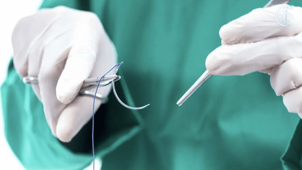 پزشک قلابی سیار در شیراز حین انجام لیپوساکشن در منزل دستگیر شد