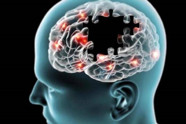 تغذیه مناسب برای افرادی که دچار آلزایمر شده‌اند