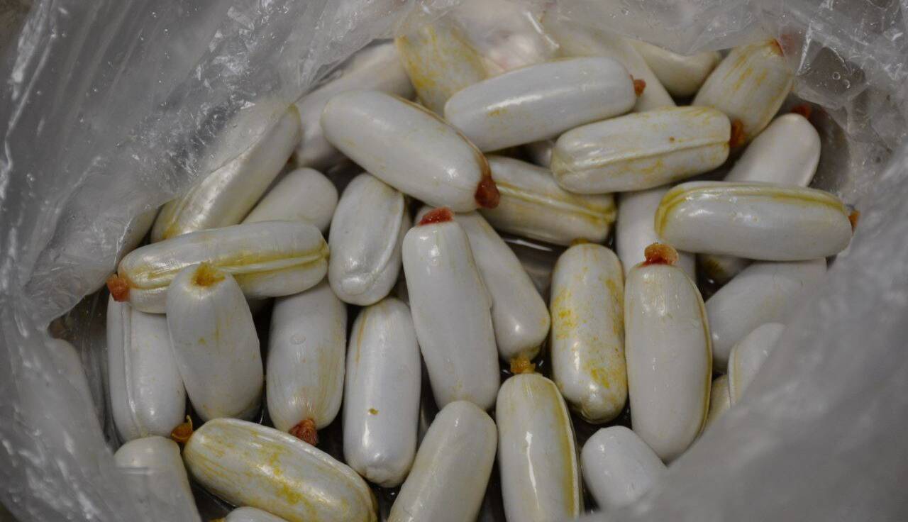 کشف ۲۳ بسته هرویین از معده یک تبعه افغان در مرز دوغارون 