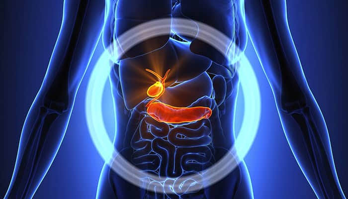 برخی از کارهای مهم برای درمان سنگ کیسه صفرا