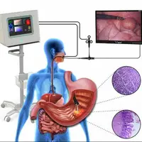 ساخت دستگاه تشخیص دقیق سرطان‌های دستگاه گوارش فوقانی