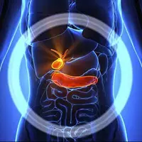 برخی از کارهای مهم برای درمان سنگ کیسه صفرا