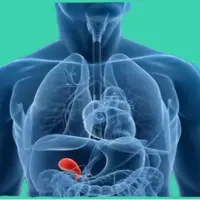 بهترین غذاهای برای سنگ کیسه صفرا سبزیجات است